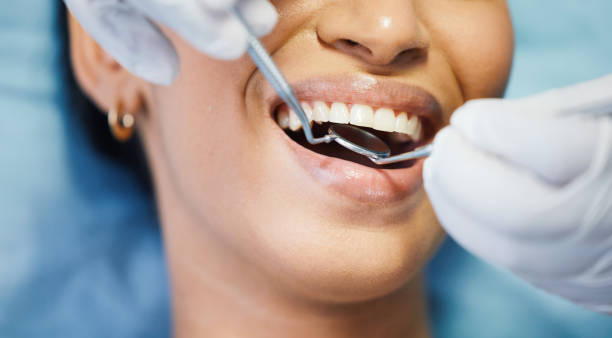 Best Emergency Denture Repair in Lone Tree, CO